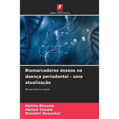 预订 Biomarcadores ósseos na doença periodontal - uma atualização: 9786209288715