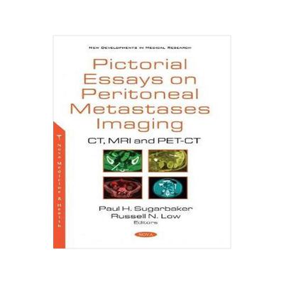 [预订]Pictorial Essays on Peritoneal Metastases Imaging: CT, MRI and PET-CT 9781536180145