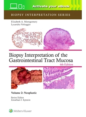 预订 Biopsy Interpretation of the Gastrointestinal Tract Mucosa Volume 2 (Biopsy Interpretation Series): Neoplastic: Pri