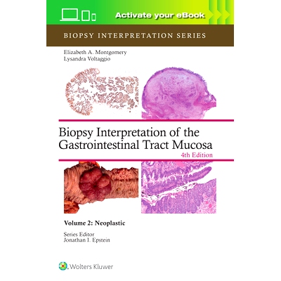 预订 Biopsy Interpretation of the Gastrointestinal Tract Mucosa Volume 2 (Biopsy Interpretation Series): Neoplastic: Pri