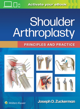 【预订】Shoulder Arthroplasty: Principles and Practice