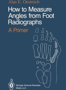 【预订】How to Measure Angles from Foot Radiographs