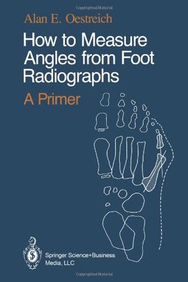 【预订】How to Measure Angles from Foot Radiographs