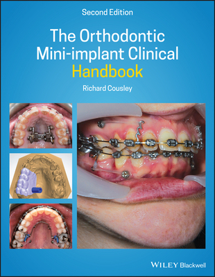 【预订】The Orthodontic Mini-Implant Clinical Handbook 2Nd Edition