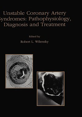【预订】Unstable Coronary Artery Syndromes Pathophysiology, Diagnosis and Treatment