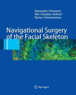 Navigational Facial Surgery the Skeleton 预订