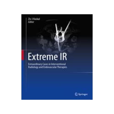 [预订]Extreme IR: Extraordinary Cases in Interventional Radiology and Endovascular Therapies 9783031242502