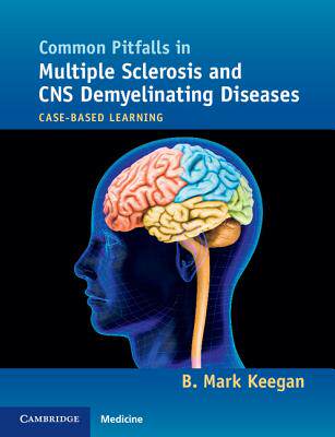 【预订】Common Pitfalls in Multiple Sclerosis and CNS Demyelinating Diseases