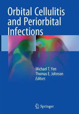 预订 Orbital Cellulitis and Periorbital Infections