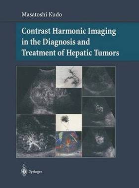 预订 Contrast Harmonic Imaging in the Diagnosis and Treatment of Hepatic Tumors