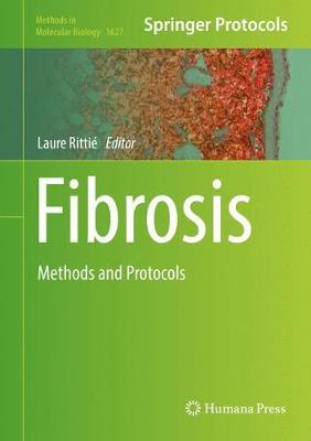 【预订】Fibrosis