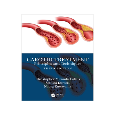 [预订]Carotid Treatment: Principles and Techniques