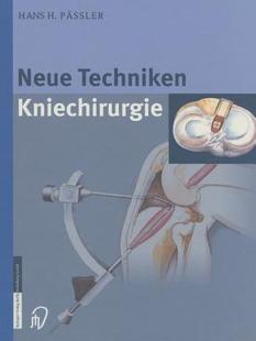 Kniechirurgie Techniken 预订 Neue