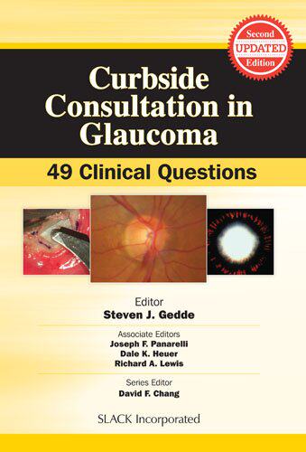 【预售】CURBSIDE CONSULTATION GLAUCOMA - 封面