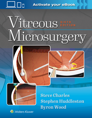 【预订】Vitreous Microsurgery 书籍/杂志/报纸 原版其它 原图主图