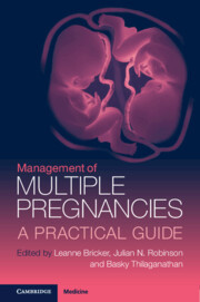 【预订】Management of Multiple Pregnancies 9781108843195