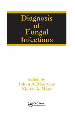 【预订】Diagnosis of Fungal Infections