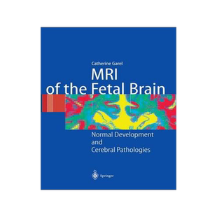 [预订]MRI of the Fetal Brain