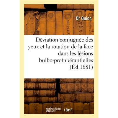 预订 Memoire Sur La Deviation Conjuguee Des Yeux Et La Rotation de la Face 关于眼睛的偏差和面部旋转的回忆录: 97820140835