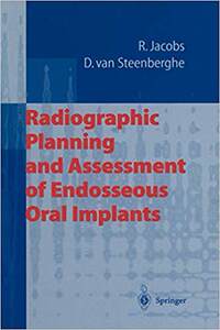 【预订】Radiographic Planning and Assessment of Endosseous Oral Implants