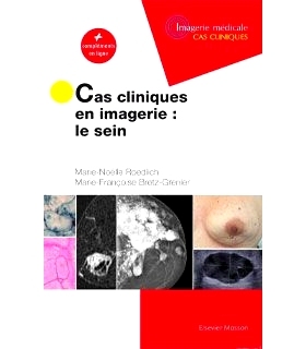 预订 Cas cliniques en imagerie : le sein : + compléments en ligne 影像学临床病例：乳房：+在线补充: 9782294769276