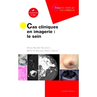 预订 Cas cliniques en imagerie : le sein : + compléments en ligne 影像学临床病例：乳房：+在线补充: 9782294769276