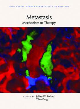 [预订]Metastasis: Mechanism to Therapy 9781621823247