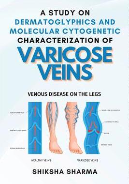 [预订]A Study on Dermatoglyphics and Molecular Cytogenetic Characterization of Varicose Veins 9782131975457
