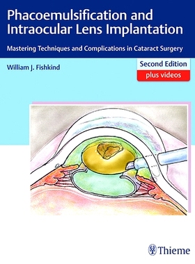 预订 Phacoemulsification and Intraocular Lens Implantation: Mastering Techniques and Complications in Cataract Surgery