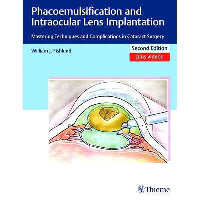 预订 Phacoemulsification and Intraocular Lens Implantation: Mastering Techniques and Complications in Cataract Surgery