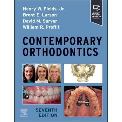 预订 Contemporary Orthodontics 当代正畸学: 9780323930710