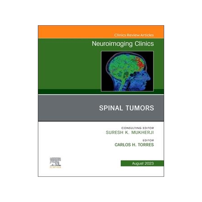 [预订]Spinal Tumors, an Issue of Neuroimaging Clinics of North America 9780323938679