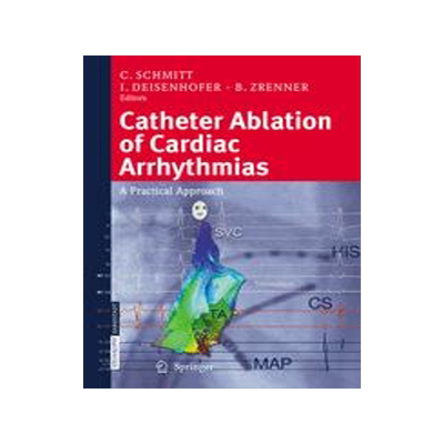 预订 Catheter Ablation of Cardiac Arrhythmias
