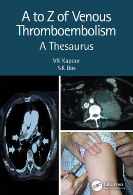 【预订】A to Z of Venous Thrombo-Embolism: A Thesaurus, 2nd Edition 9780367753009