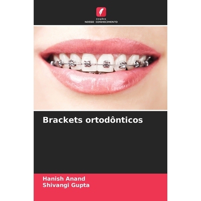 预订 Brackets ortodônticos: 9786209053665