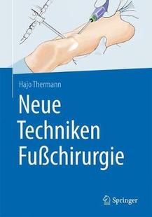 Fußchirurgie Techniken 预订 Neue