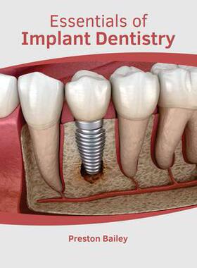 [预订]Essentials of Implant Dentistry 9781639270538