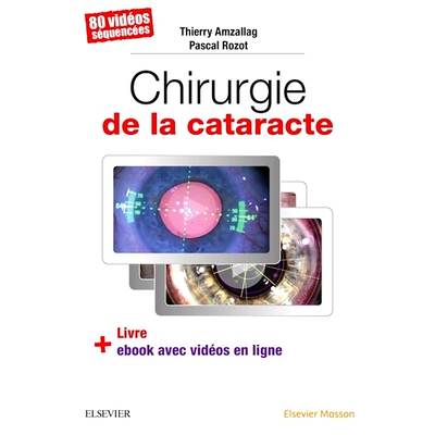 预订 Chirurgie de la cataracte : 80 vidéos séquencées : livre + ebook avec vidéos en ligne 白内障手术：80 个序列视频