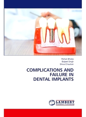 预订 Complications and Failure in Dental Implants 种植牙的并发症和失败: 9786208117184