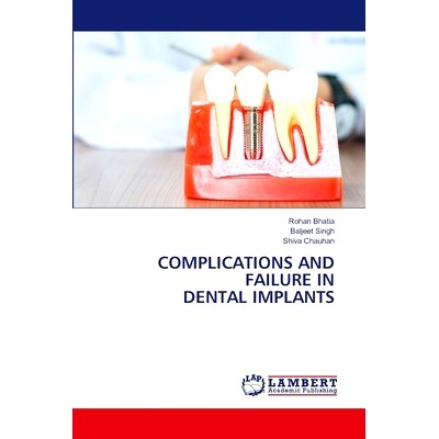 预订 Complications and Failure in Dental Implants 种植牙的并发症和失败: 9786208117184