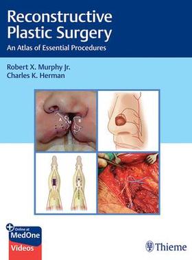 [预订]Reconstructive Plastic Surgery 9781626235175