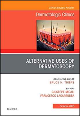 【预售】Alternative Uses of Dermatoscopy, An Issue of Dermatologic Clinics