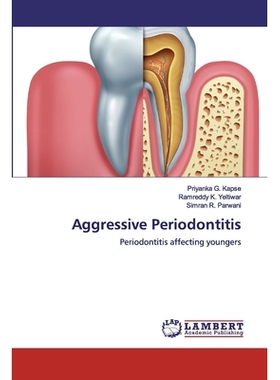 预订 Aggressive Periodontitis:Periodontitis affecting youngers: Periodontitis affecting youngers 侵袭性牙周炎:牙周炎影响