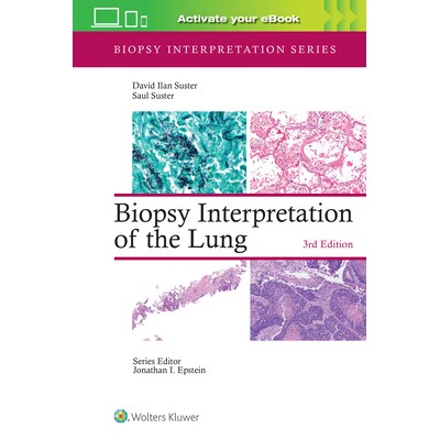 预订 Biopsy Interpretation of the Lung: Print + eBook with Multimedia: 9781975240677