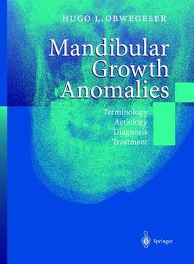 【预订】Mandibular Growth Anomalies