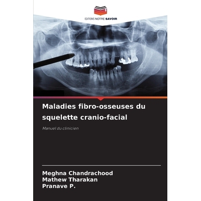 预订 Maladies fibro-osseuses du squelette cranio-facial: Manuel du clinicien: 9786209118197