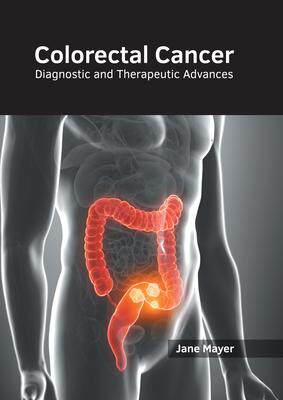 [预订]Colorectal Cancer: Diagnostic and Therapeutic Advances 9781632418746
