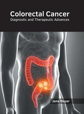 [预订]Colorectal Cancer: Diagnostic and Therapeutic Advances 9781632418746