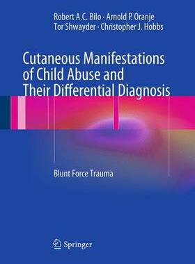 预订 Cutaneous Manifestations of Child Abuse and Their Differential Diagnosis