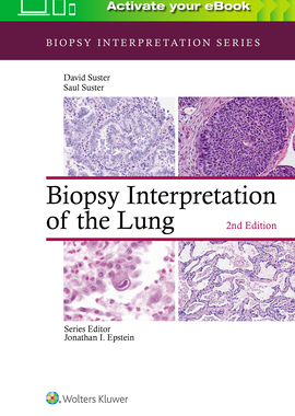 【预订】Biopsy Interpretation of the Lung